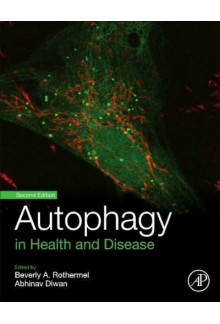 Autophagy in Health and Disease - Humanitas