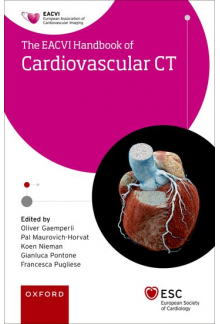 EACVI Handbook of Cardiovascular CT - Humanitas