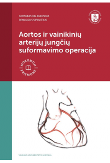 Aortos ir vainikinių arterijųjungčių suformavimo operacija - Humanitas