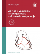 Aortos ir vainikinių arterijųjungčių suformavimo operacija Humanitas