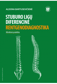 Stuburo ligų diferencinė rentgenodiagnostika - Humanitas