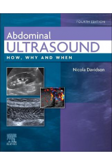 Abdominal Ultrasound - Humanitas