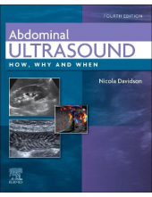 Abdominal Ultrasound - Humanitas