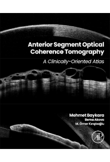 Anterior Segment Optical Coherence Tomography - Humanitas