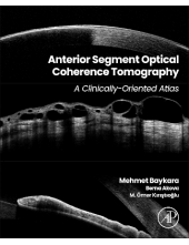 Anterior Segment Optical Coherence Tomography - Humanitas
