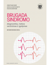 Brugada sindromo diagnostika, rizikos vertinimas ir gydymas - Humanitas