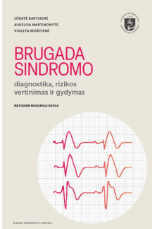 Brugada sindromo diagnostika, rizikos vertinimas ir gydymas - Humanitas