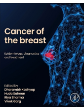 Cancer of the Breast - Humanitas