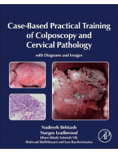Case-Based Practical Training of Colposcopy and Cervical Pathology - Humanitas