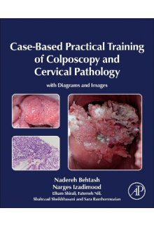 Case-Based Practical Training of Colposcopy and Cervical Pathology - Humanitas
