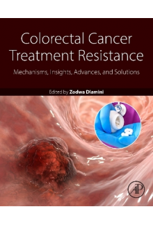 Colorectal Cancer Treatment Resistance - Humanitas