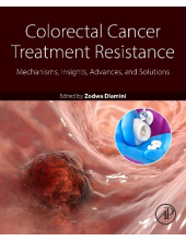 Colorectal Cancer Treatment Resistance - Humanitas