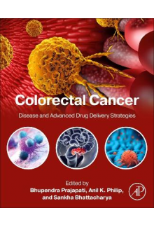 Colorectal Cancer - Humanitas