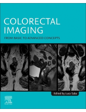 Colorectal Imaging - Humanitas