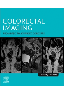 Colorectal Imaging - Humanitas