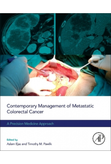 Contemporary Management of Metastatic Colorectal Cancer - Humanitas