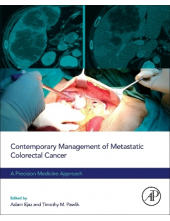 Contemporary Management of Metastatic Colorectal Cancer - Humanitas