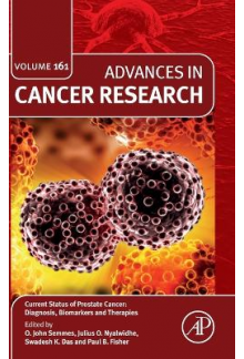 Current Status of Prostate Cancer: Diagnosis, Biomarkers and Therapies - Humanitas