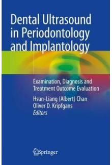 Dental Ultrasound in Periodon tology and Implantology - Humanitas