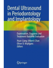 Dental Ultrasound in Periodon tology and Implantology - Humanitas