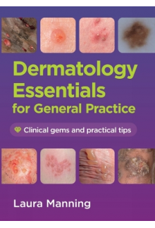 Dermatology Essentials for Gen eral Practice - Humanitas