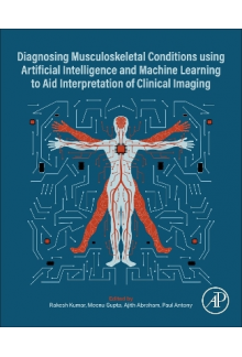 Diagnosing Musculoskeletal Conditions using Artifical Intelligence and Machine Learning to Aid Interpretation of Clinical Imaging - Humanitas