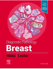 Diagnostic Pathology: Breast - Humanitas