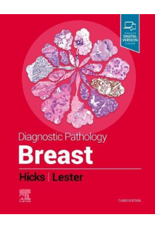 Diagnostic Pathology: Breast - Humanitas
