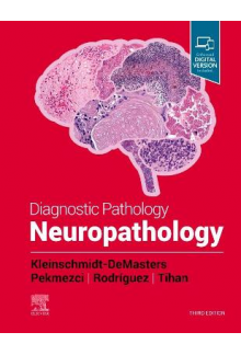 Diagnostic Pathology: Neuropathology - Humanitas