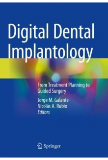 Digital Dental Implantology - Humanitas