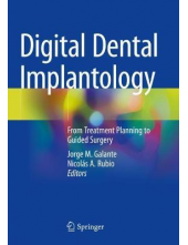 Digital Dental Implantology - Humanitas