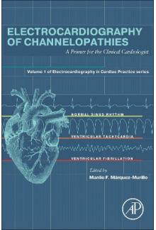 Electrocardiography of Channelopathies - Humanitas