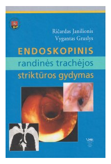 Endoskopinis randinės trachėjos struktūros gydymas - Humanitas