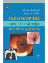 Endoskopinis randinės trachėjos struktūros gydymas - Humanitas