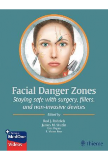 Facial Danger Zones : Staying safe with surgery,fillers , an - Humanitas