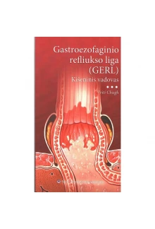 Gastroezofaginio refliukso liga (GERL) Kišeninis vadovas - Humanitas