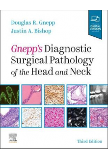Gnepp's Diagnostic Surgical Pathology of the Head and Neck - Humanitas