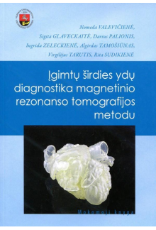 Įgimtų širdies ydų diagnostika magnetinio rezonanso tomografijos metodu - Humanitas