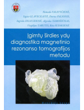 Įgimtų širdies ydų diagnostika magnetinio rezonanso tomografijos metodu - Humanitas
