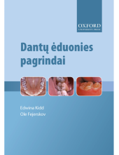 Dantų ėduonies pagrindai - Humanitas