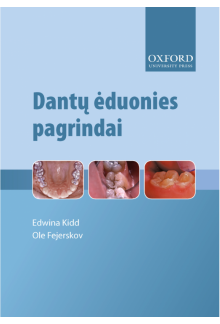 Dantų ėduonies pagrindai - Humanitas