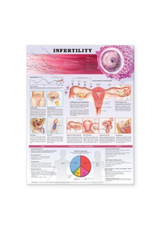 Infertility Anatomical Chart - Humanitas