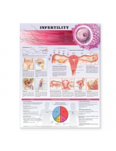 Infertility Anatomical Chart - Humanitas