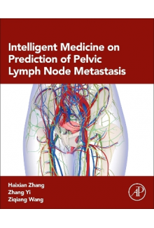 Intelligent Medicine on Prediction of Pelvic Lymph Node Metastasis - Humanitas