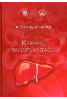 Kepenų transplantacija: monografija - Humanitas