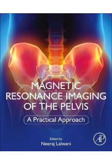 Magnetic Resonance Imaging of The Pelvis - Humanitas