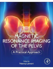 Magnetic Resonance Imaging of The Pelvis - Humanitas