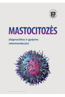Mastocitozės diagnostikos irgydymo rekomendacijos - Humanitas