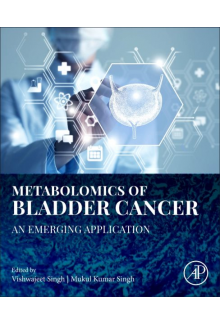 Metabolomics of Bladder Cancer - Humanitas