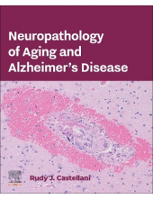 Neuropathology of Aging and Alzheimer’s Disease - Humanitas